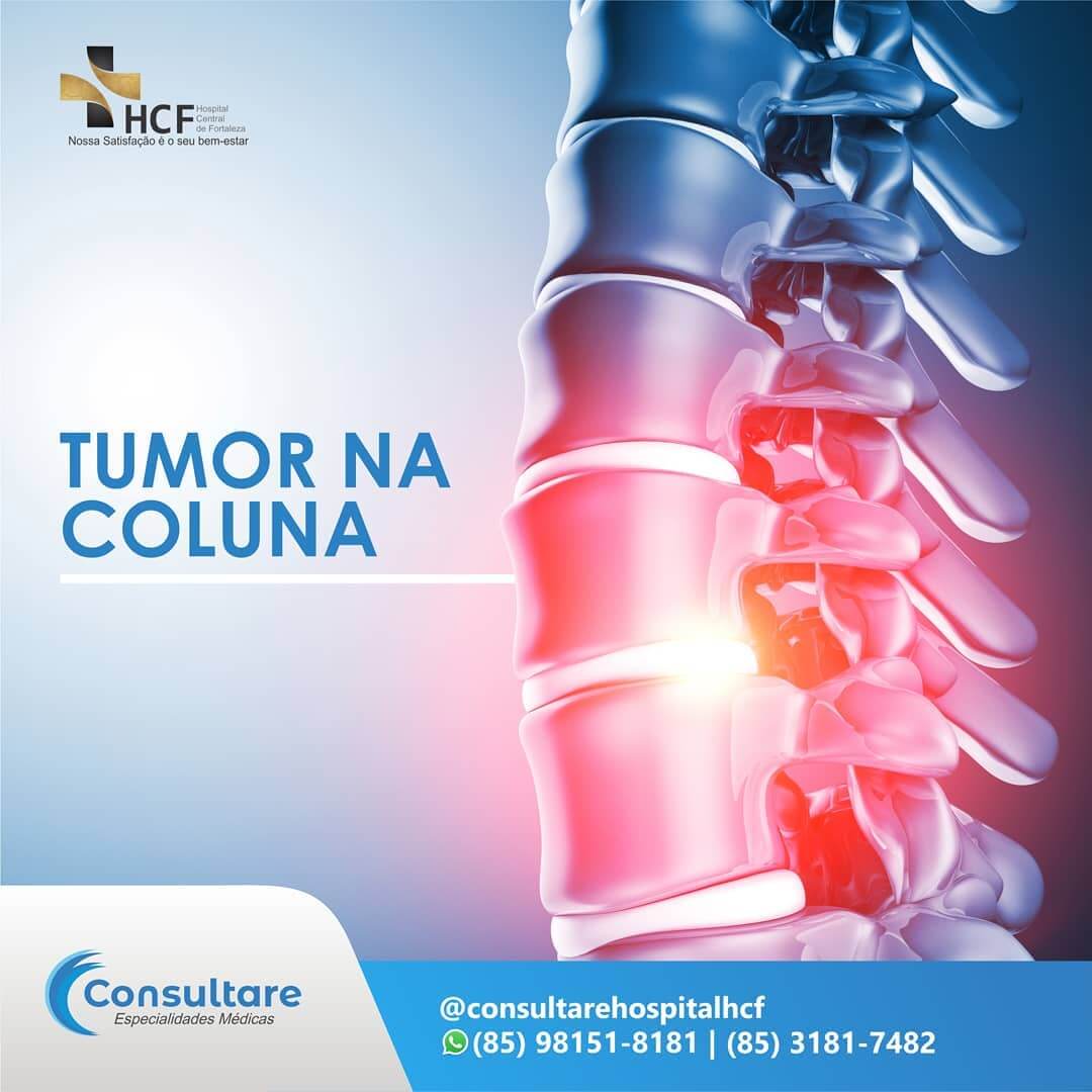 Tumor na Coluna!