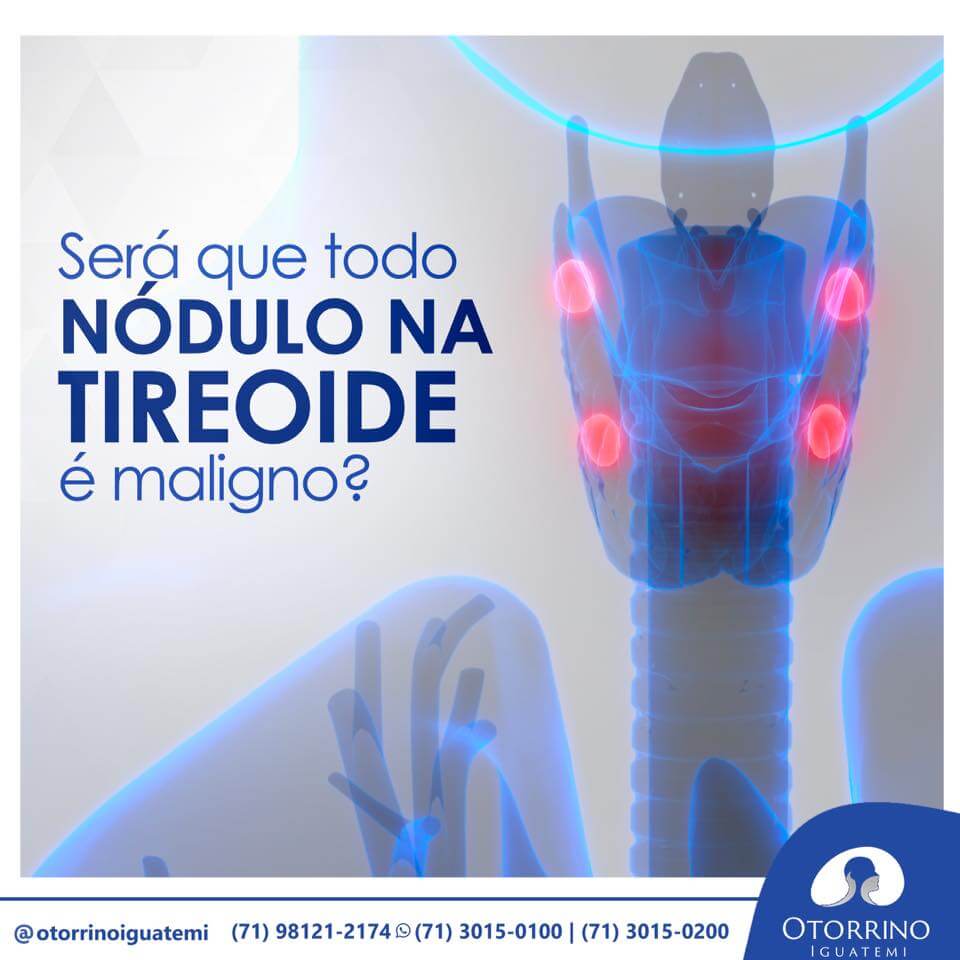 Todo Nódulo na Tireoide é maligno?