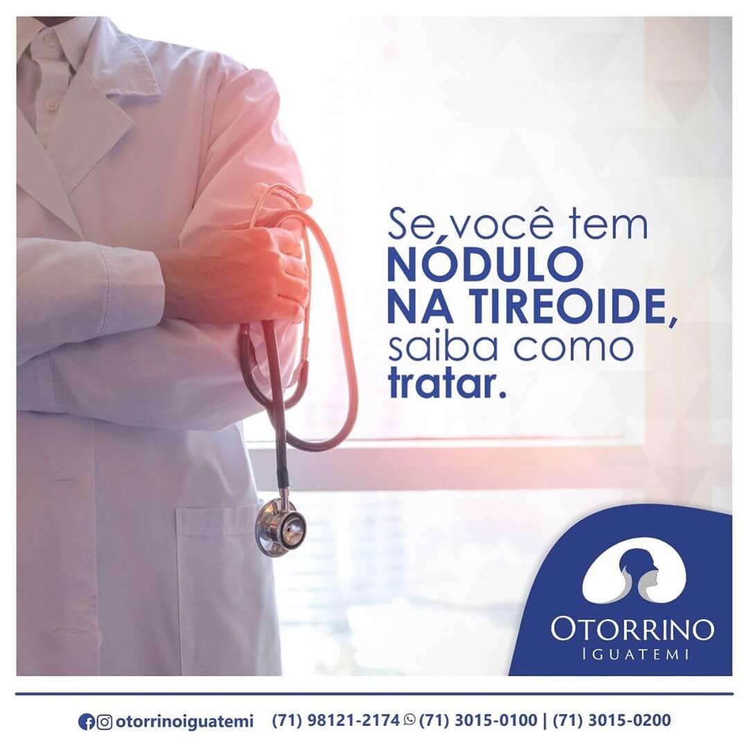 Como tratar Nódulo na Tireoide?