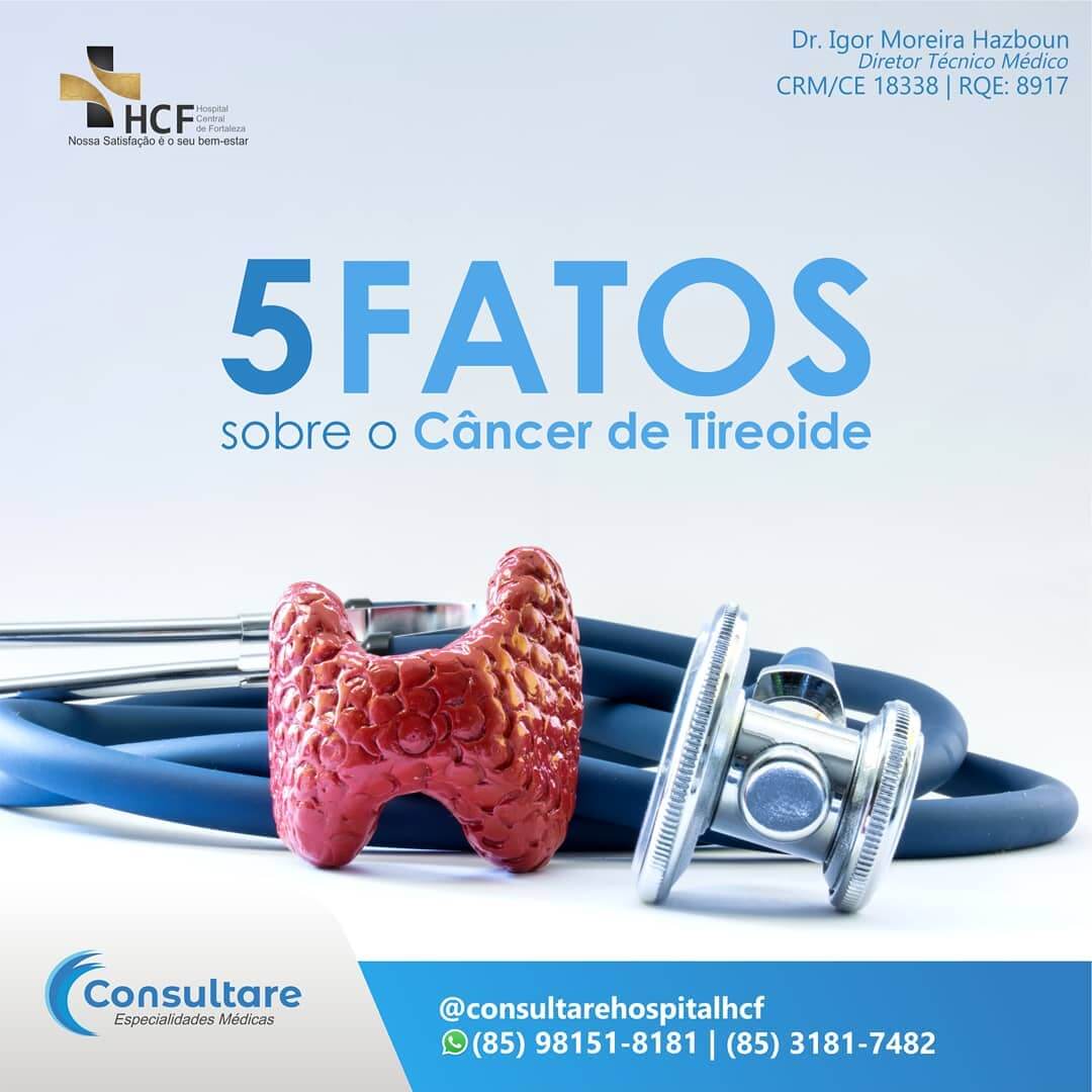 5 Fatos sobre o Câncer de Tireoide