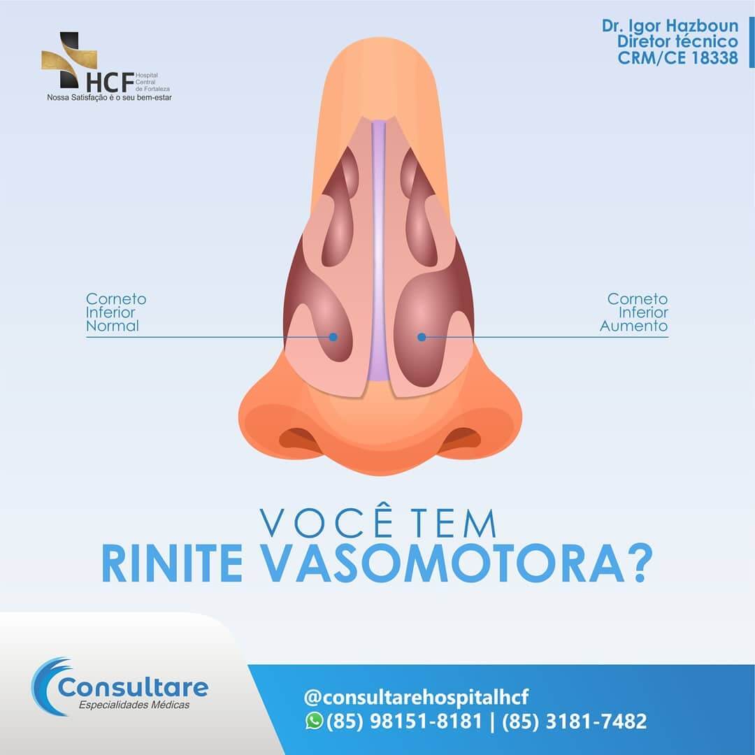 Você tem rinite Vasomotora?