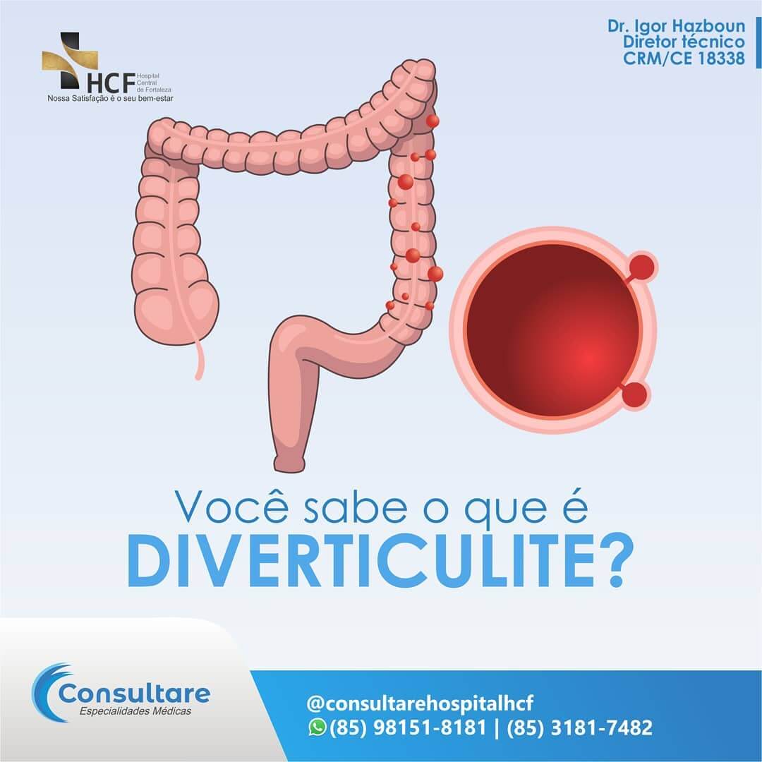 Você sabe o que é Diverticulite?