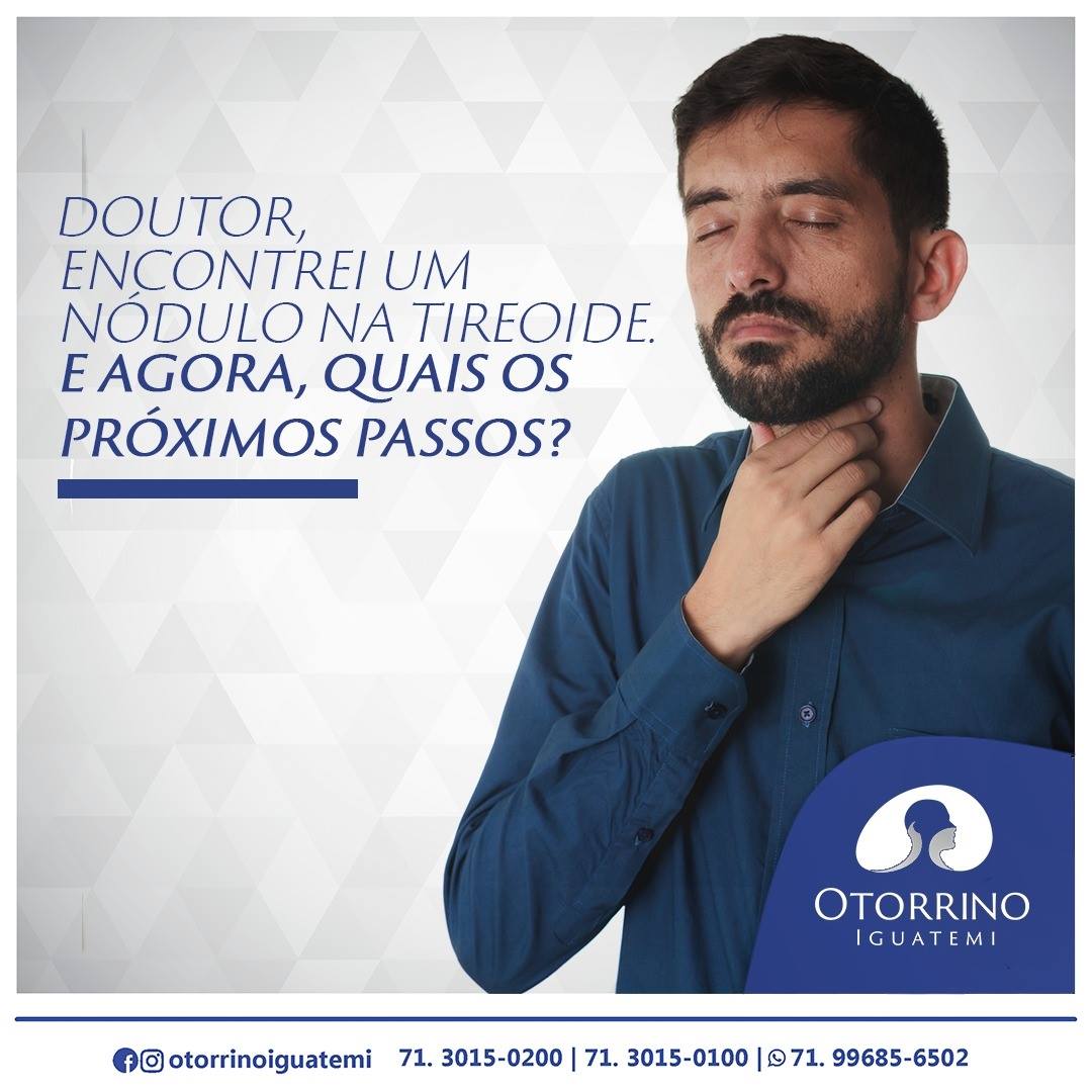OTORRINO IGUATEMI: Os nódulos de tireoide