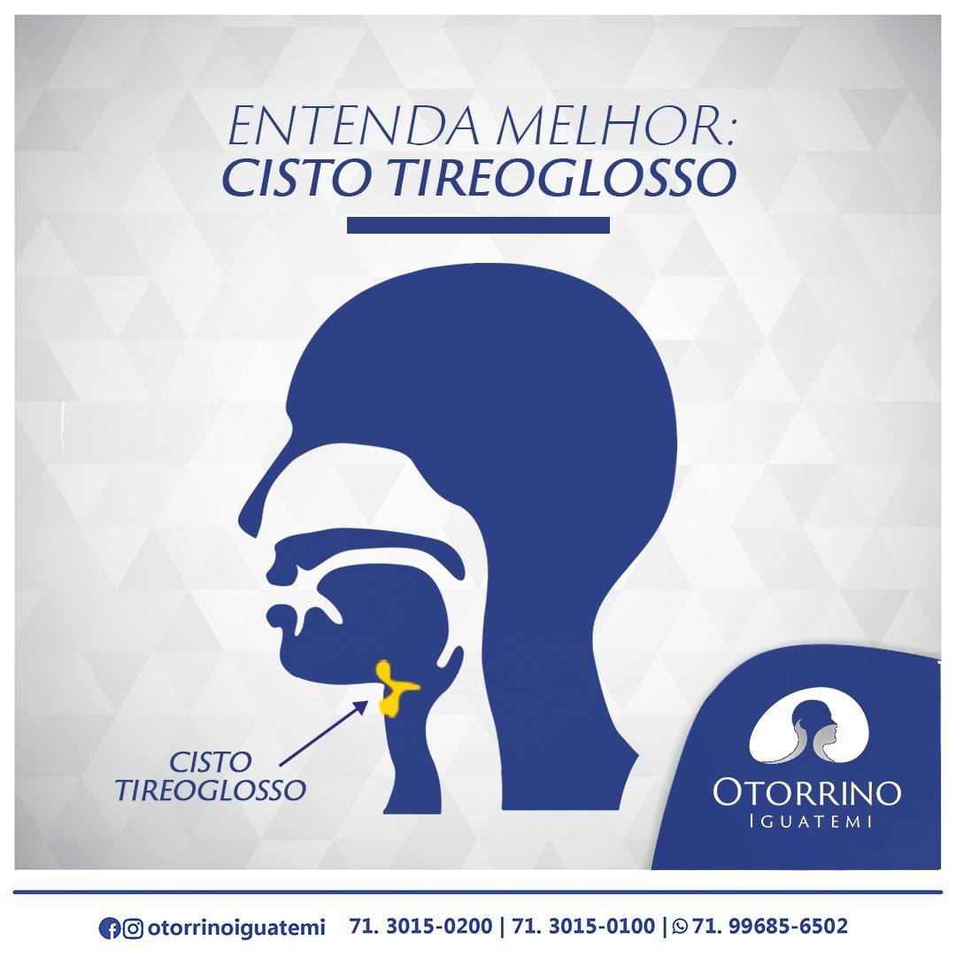 OTORRINO IGUATEMI