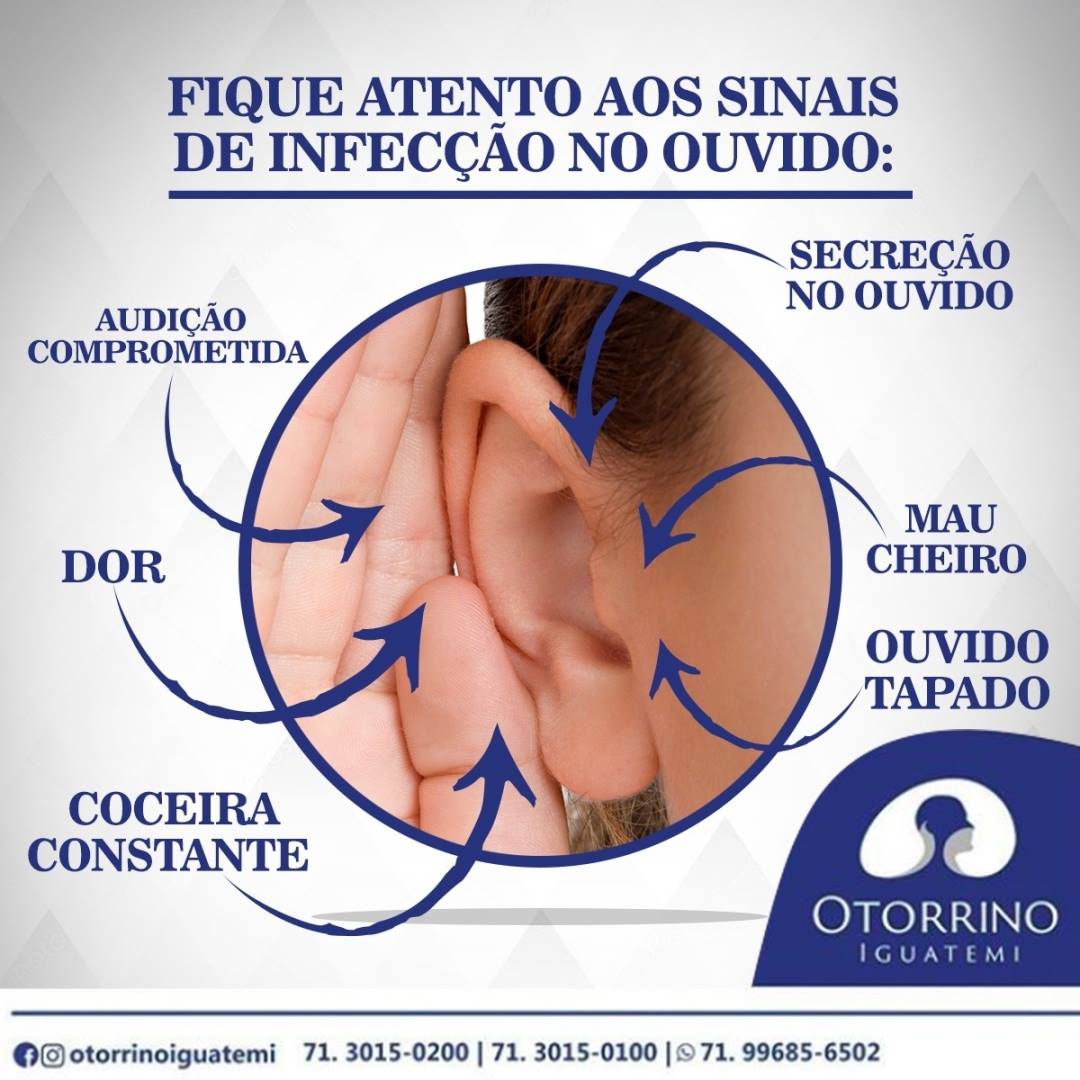OTORRINO IGUATEMI: A otite é uma infecção