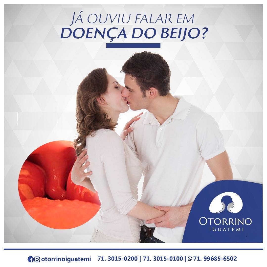 OTORRINO IGUATEMI: A Mononucleose