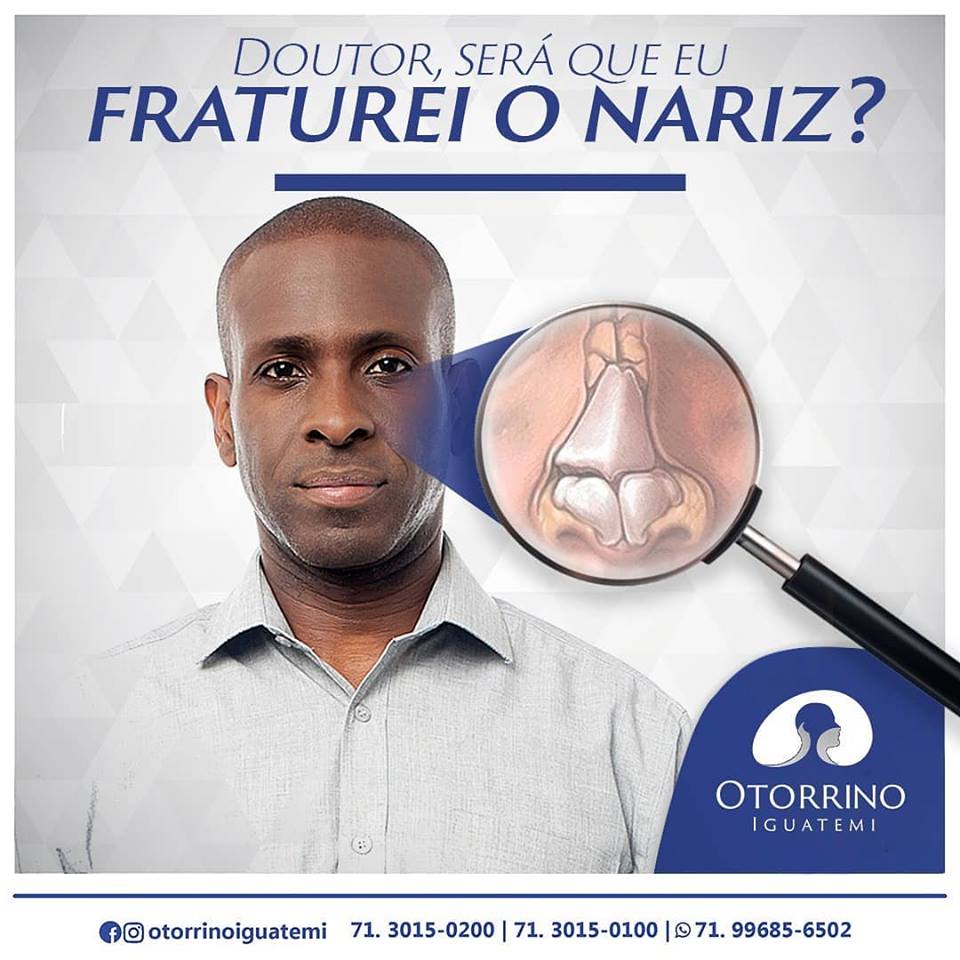 Otorrino Iguatemi - Será que fraturei o nariz?