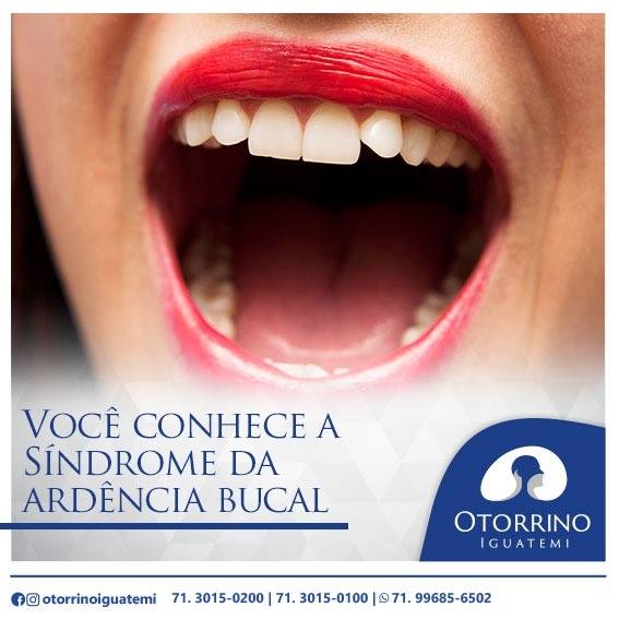 Otorrino Iguatemi - O que é Síndrome da ardência bucal?