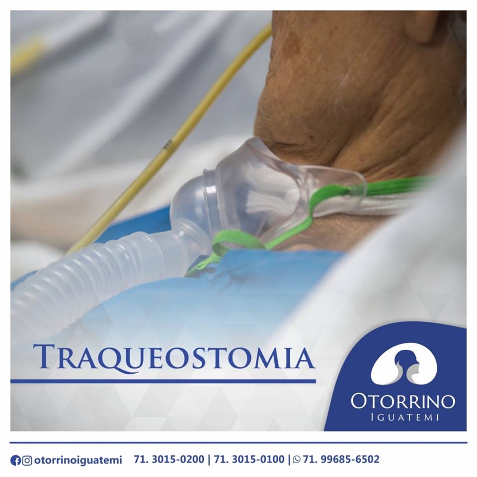 Otorrino Iguatemi - O que é traqueostomia?