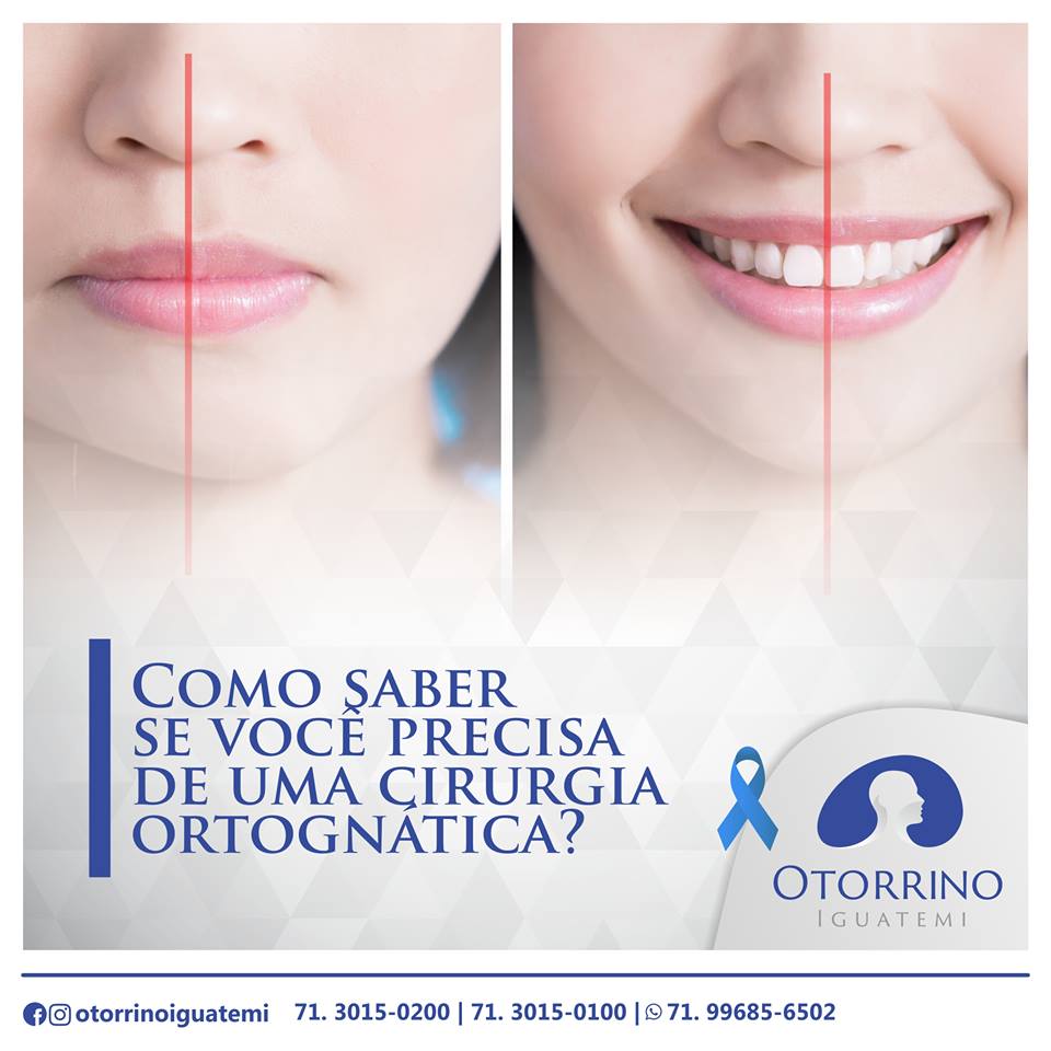 A clínica Otorrino Iguatemi tira suas dúvidas!