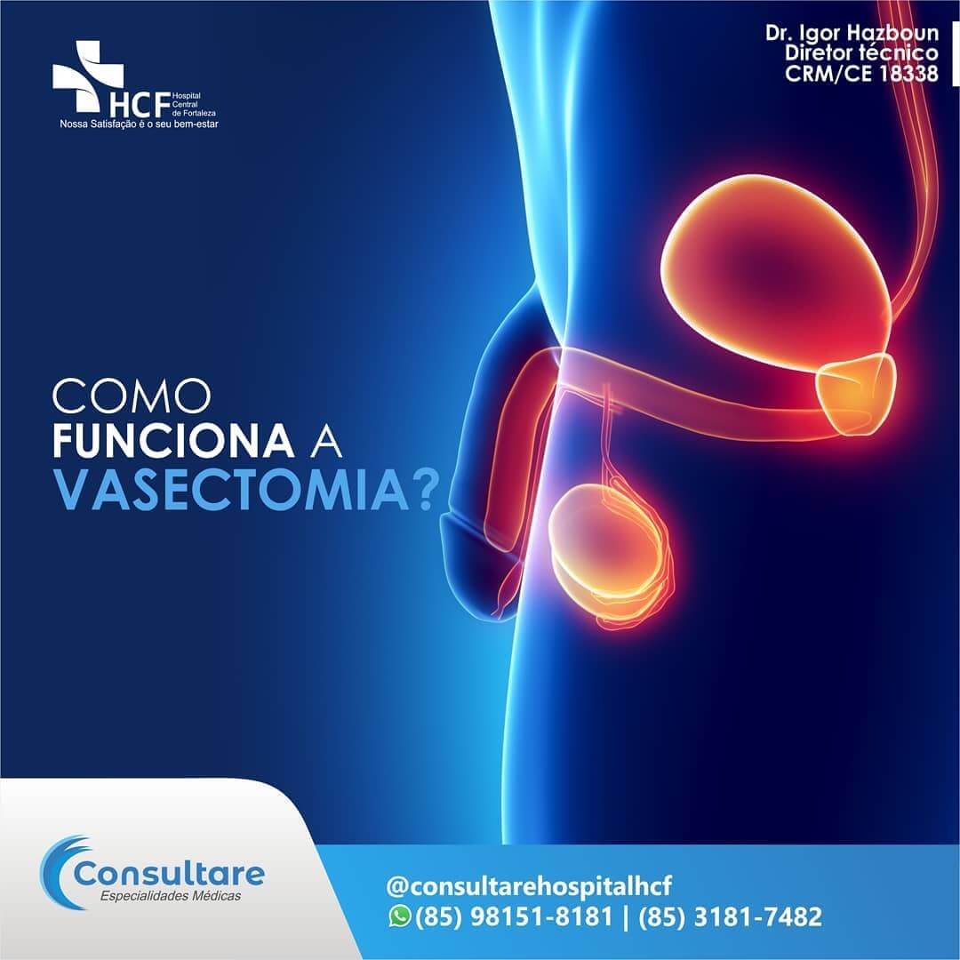 Como funciona a Vasectomia?
