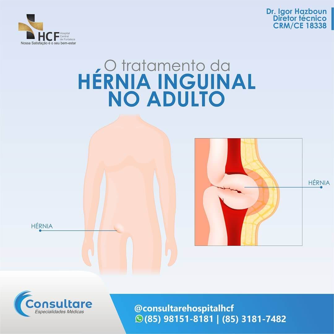 Tratamento da Hérnia Inguinal no Adulto