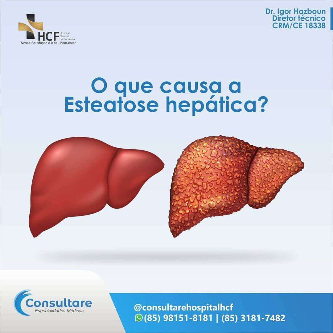 O que causa a Esteatose Hepática?