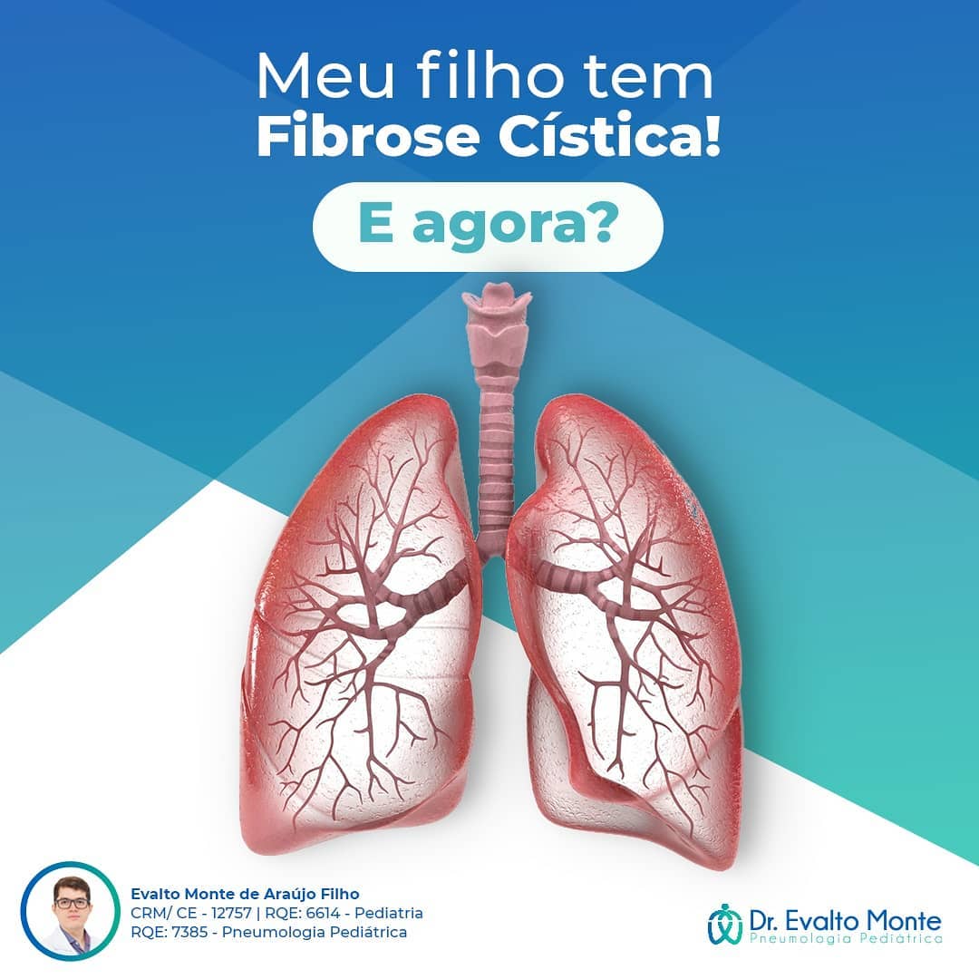 Porque Pessoas Com Fibrose Cistica Nao Podem Ficar Perto