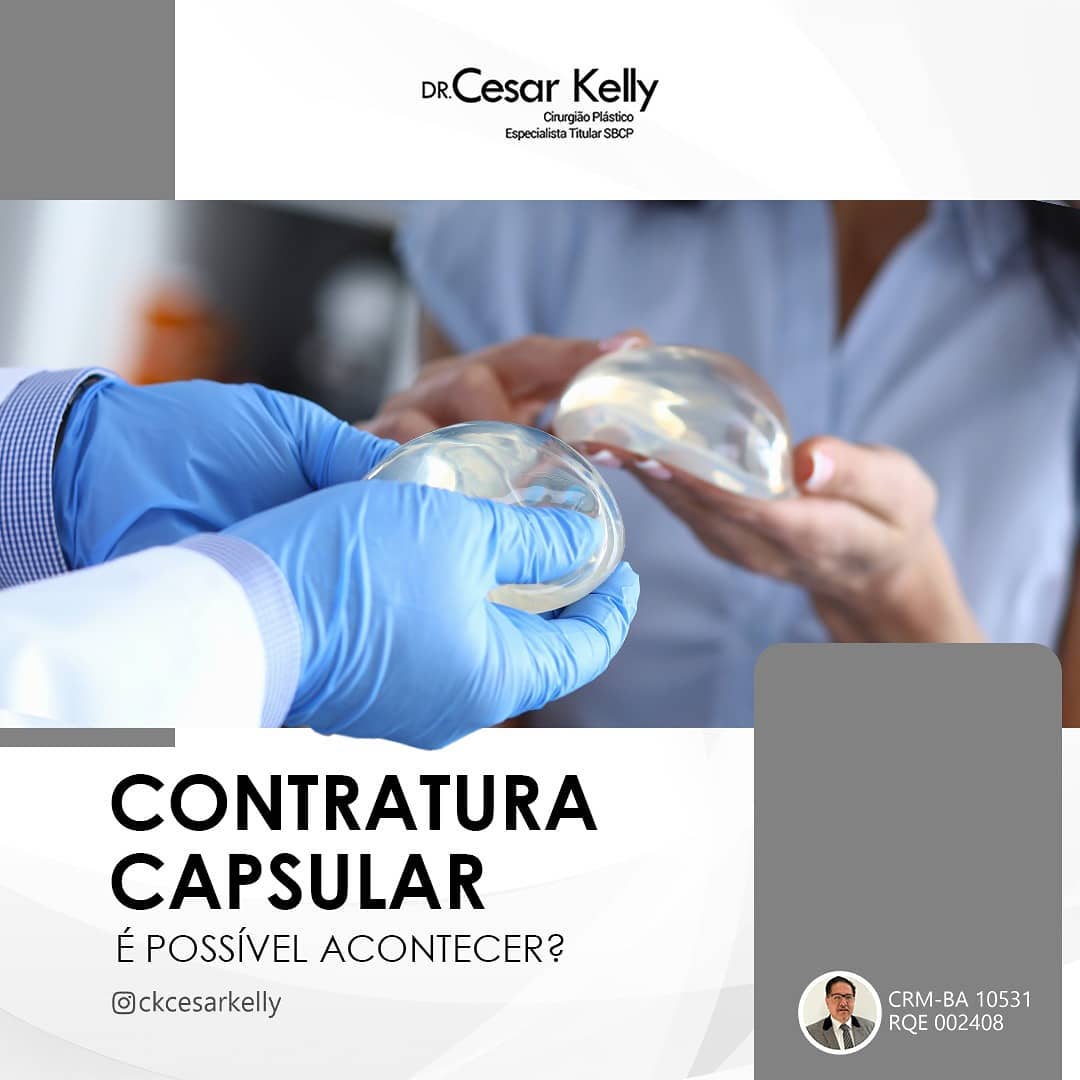 O que pode causar contratura capsular?