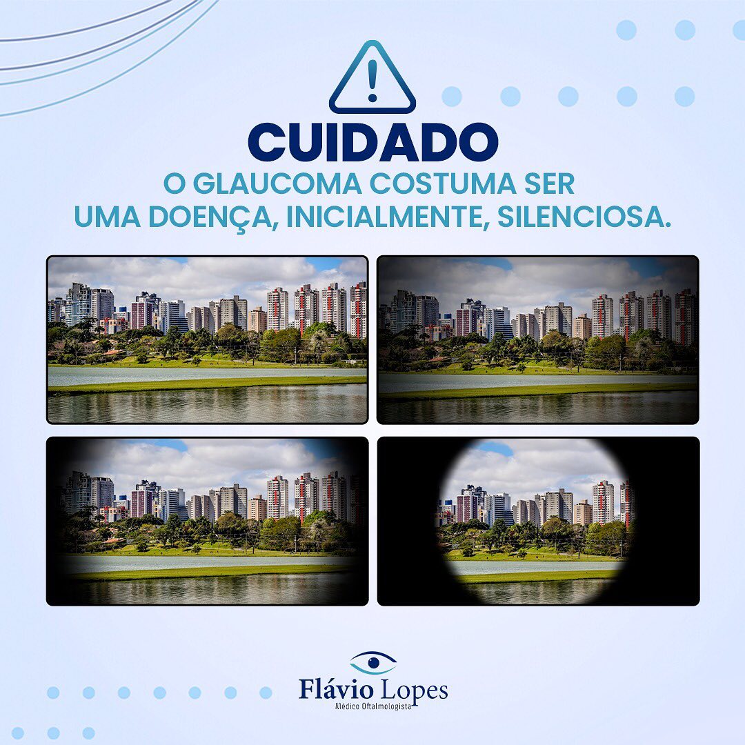 Vamos saber um pouco mais sobre o glaucoma!