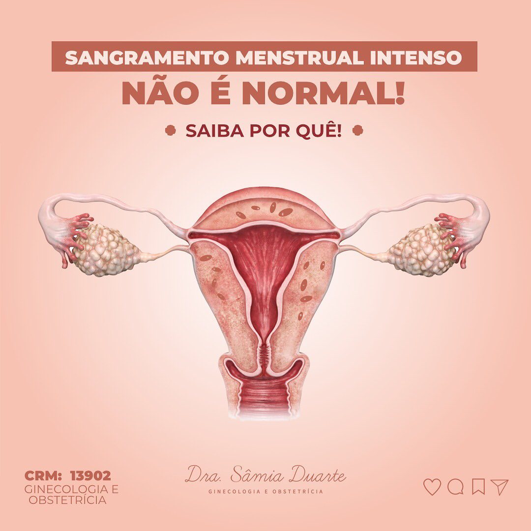 Porque prestar atenção ao fluxo menstrual intenso?