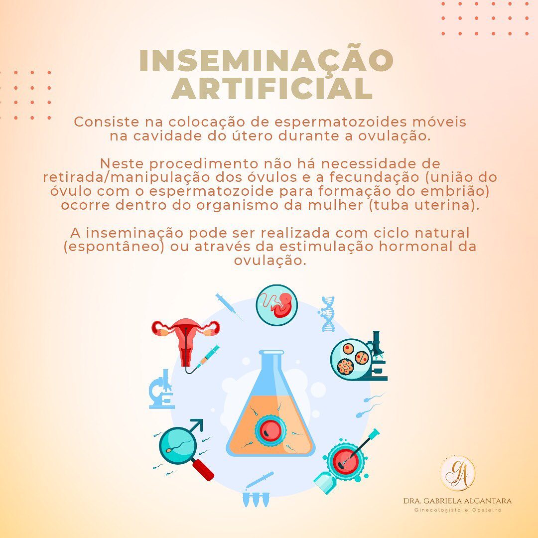 Qual A Diferença Entre Inseminação Artificial E Fertilização In Vitro ...