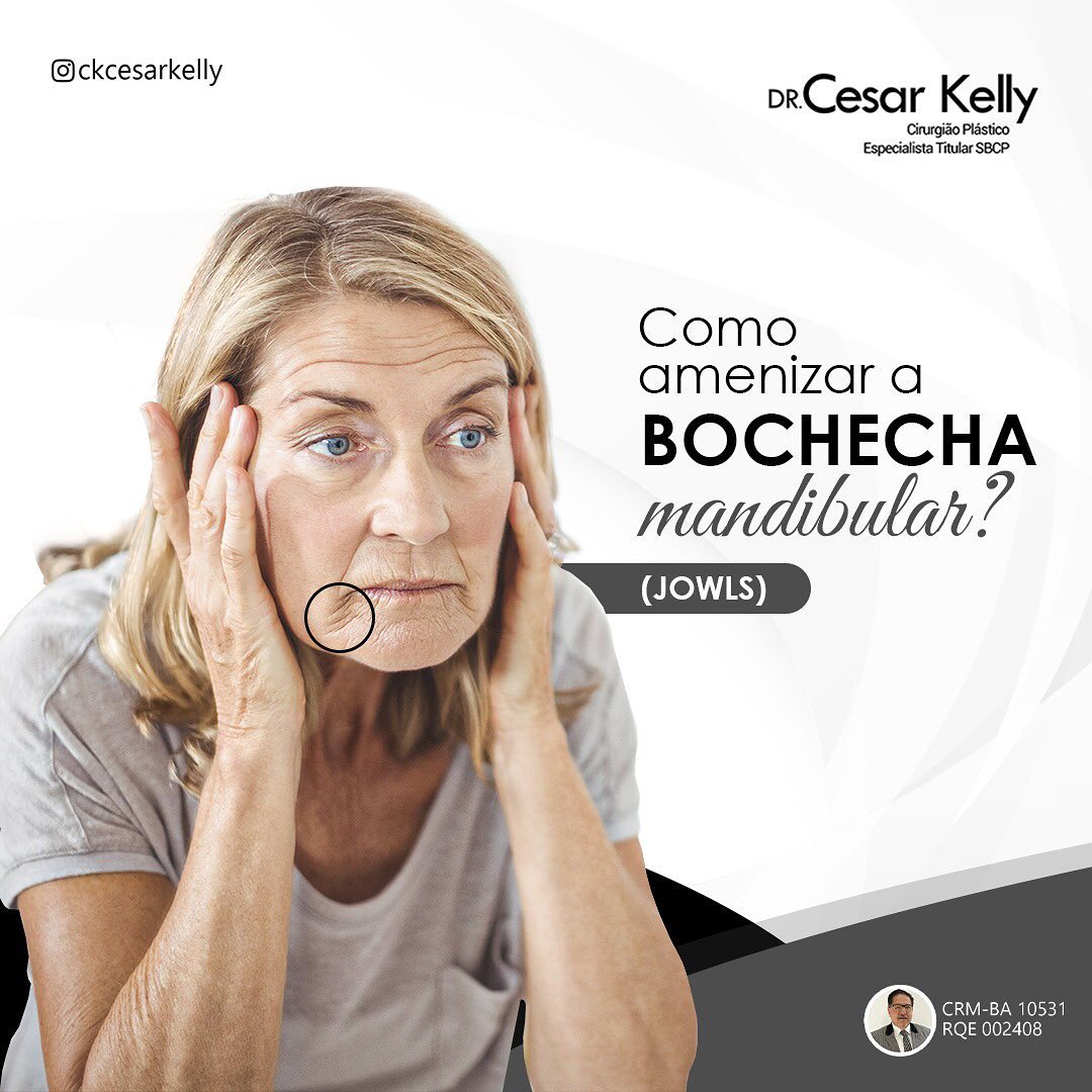 Qual o grau da sua flacidez ?  Bochecha mandibular.