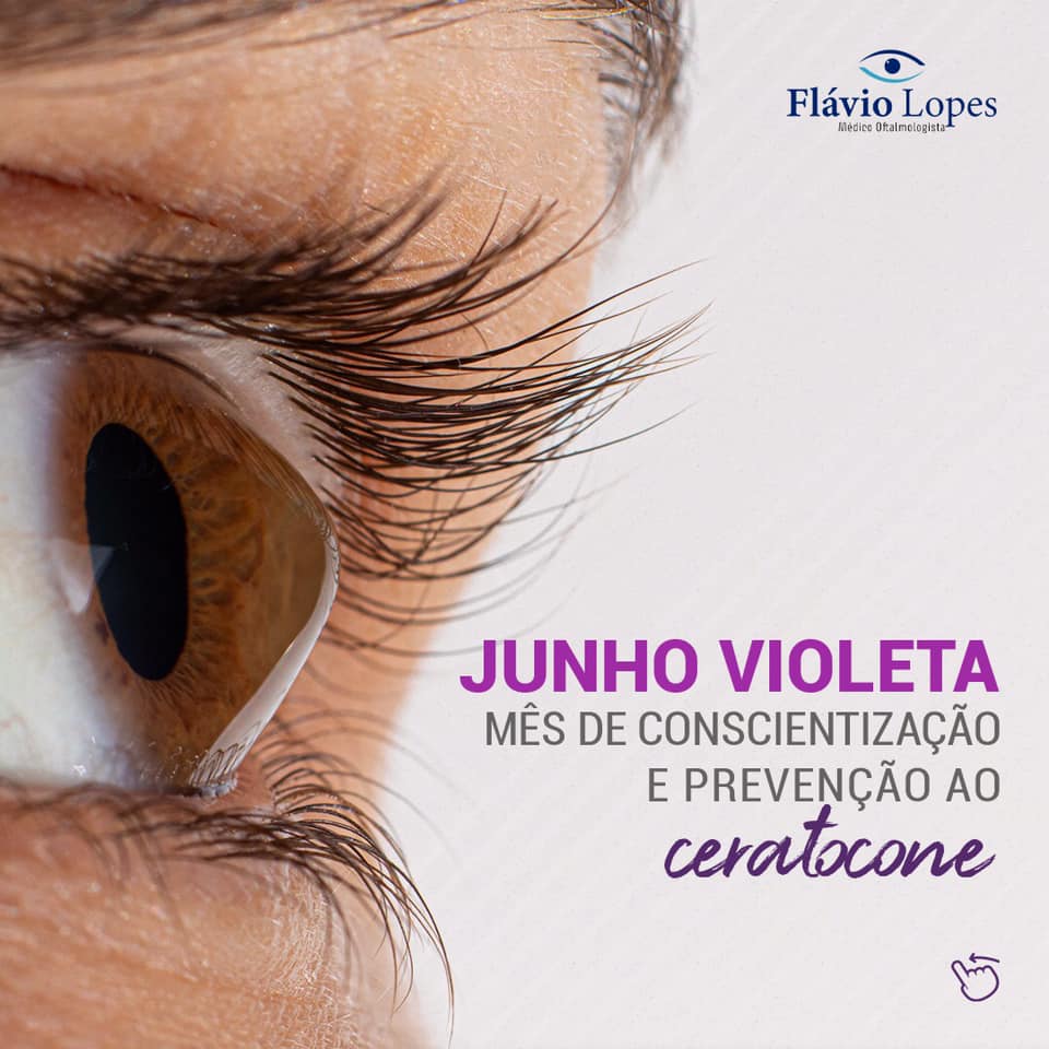 Junho Violeta - Mês de Conscientização e Prevenção ao Ceratocone
