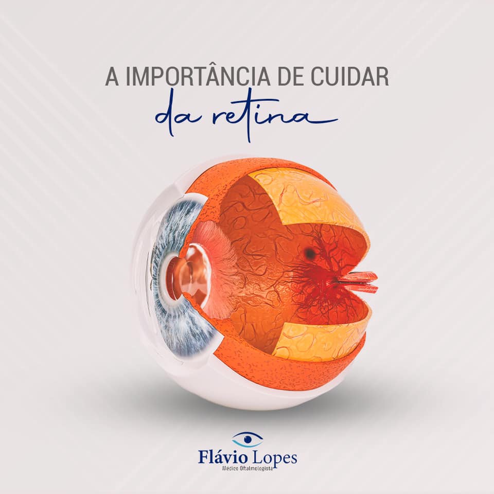 Será que você está cuidando bem da sua retina?