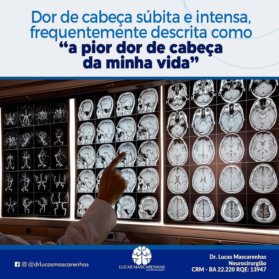 Como é a dor de cabeça de  quem tem  aneurisma?