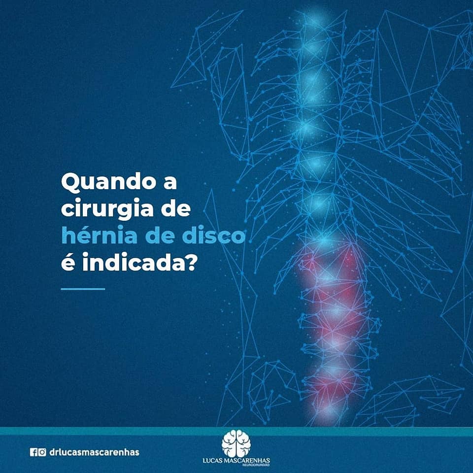 Como está a sua memória?