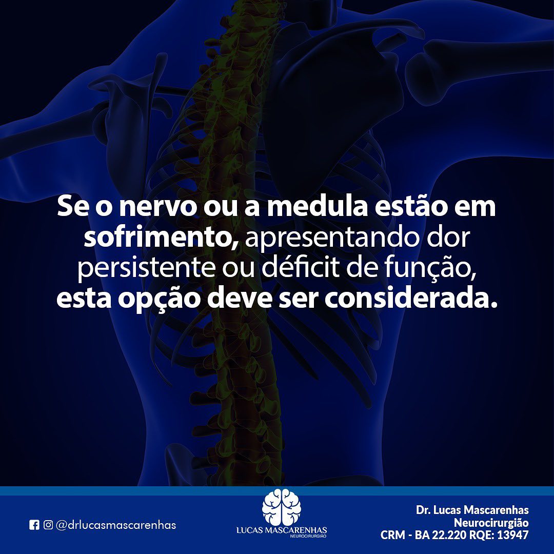 Quando que é recomendado  a cirurgia na  coluna?