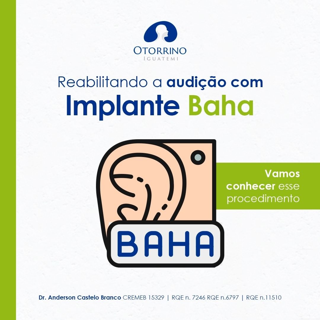 BAHA vamos conhecer esse procedimento?