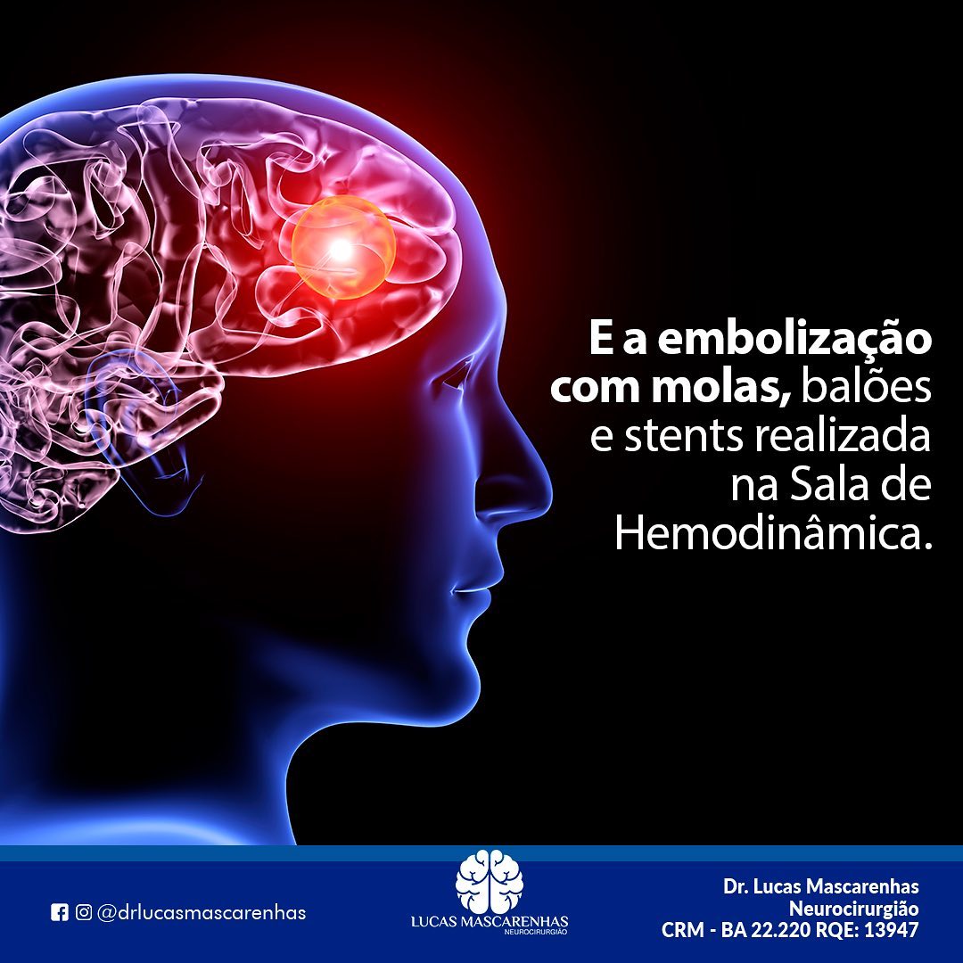 Aneurisma  cerebral   como tratar?