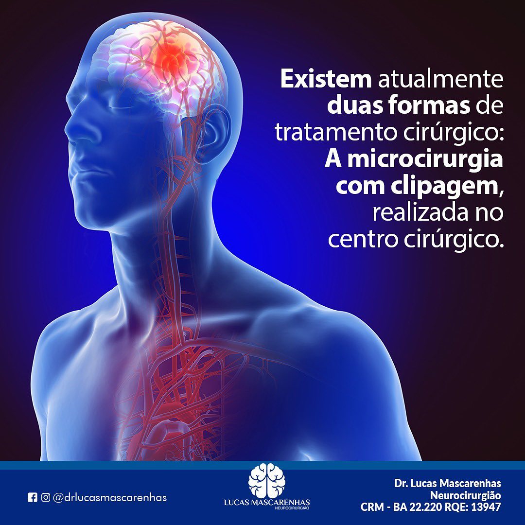 Aneurisma  cerebral   como tratar?