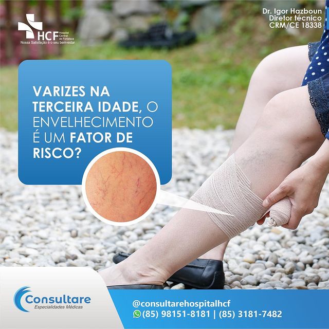 Varizes na terceira idade: fatores de risco e prevenção!