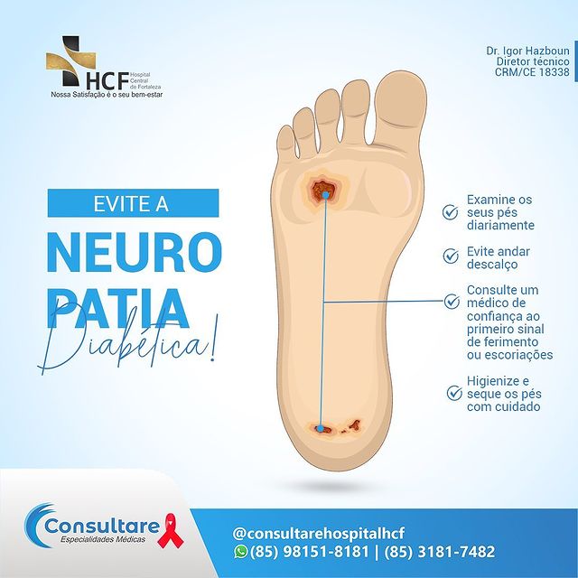 O que é  Neuropatia?