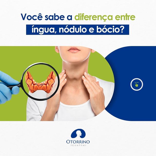 Você já ouviu falar em íngua, nódulo e bócio?