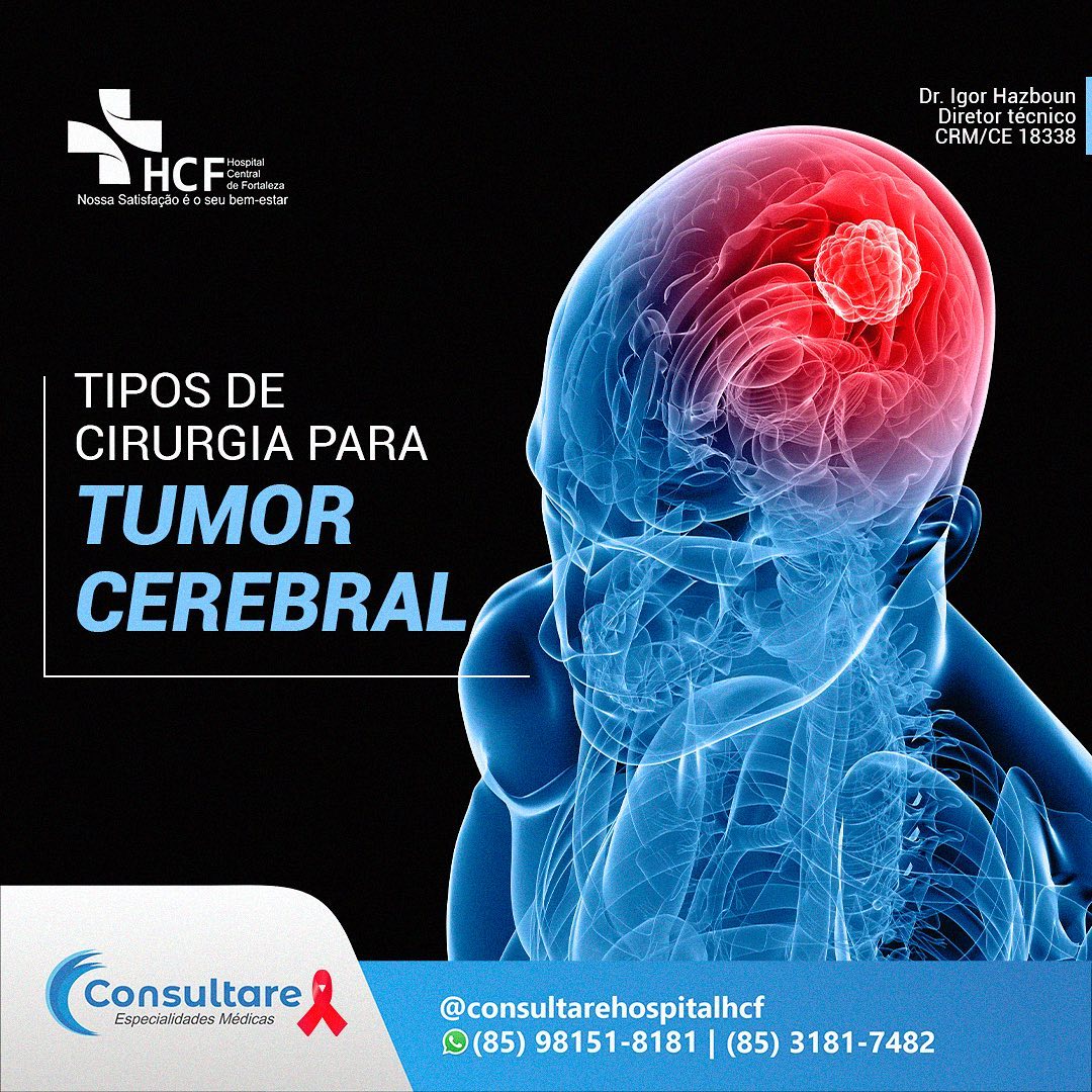  Nossa equipe conta com um neurologista experiente para tirar suas dúvidas!