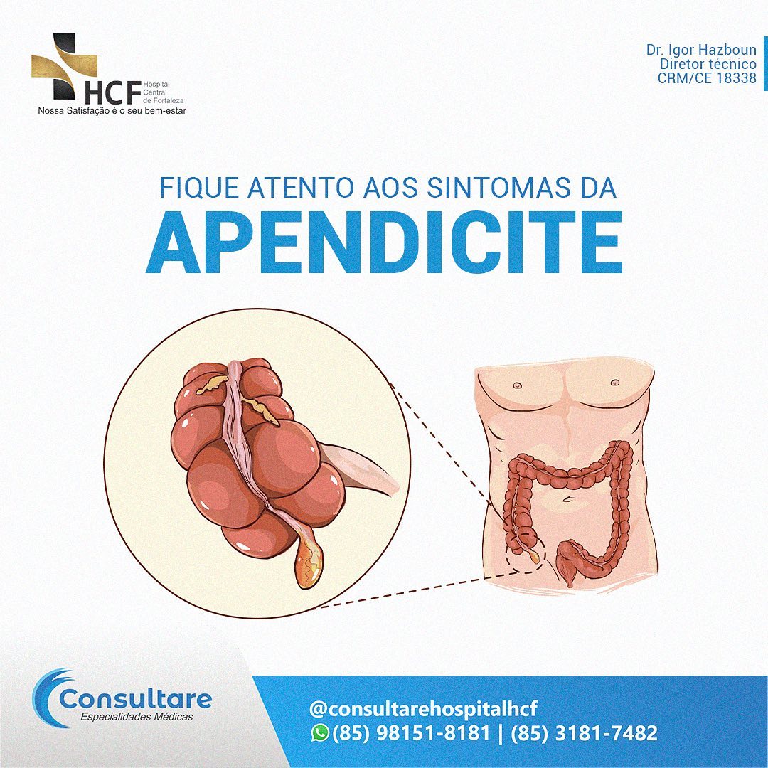Como saber que está com apendicite?