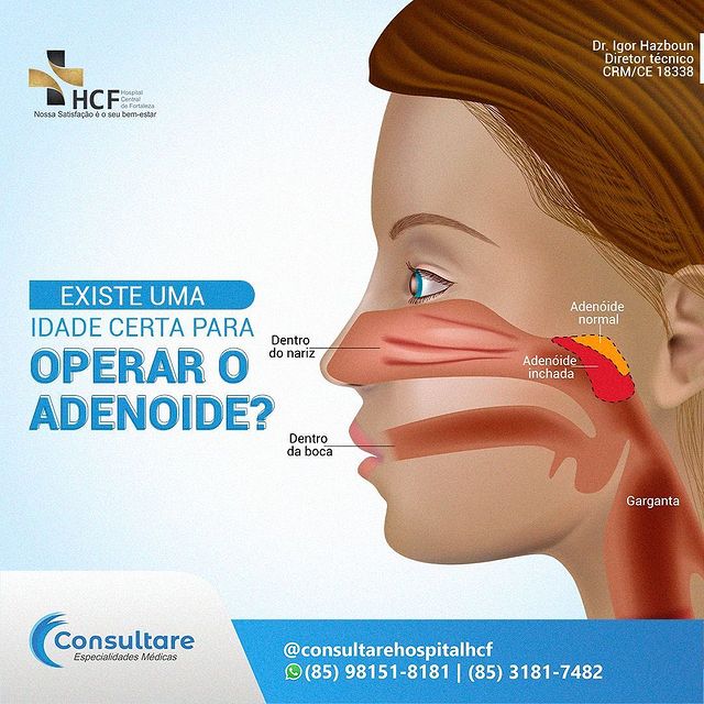 Possui alguma dúvida sobre o procedimento?