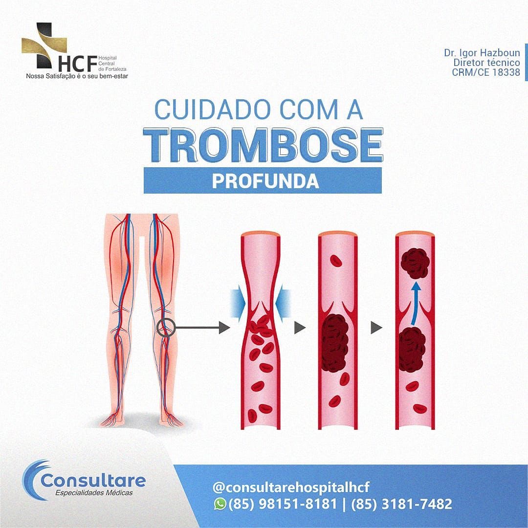 Mantenha sempre seus exames de rotina em dia e não negligencie sua saúde vascular.