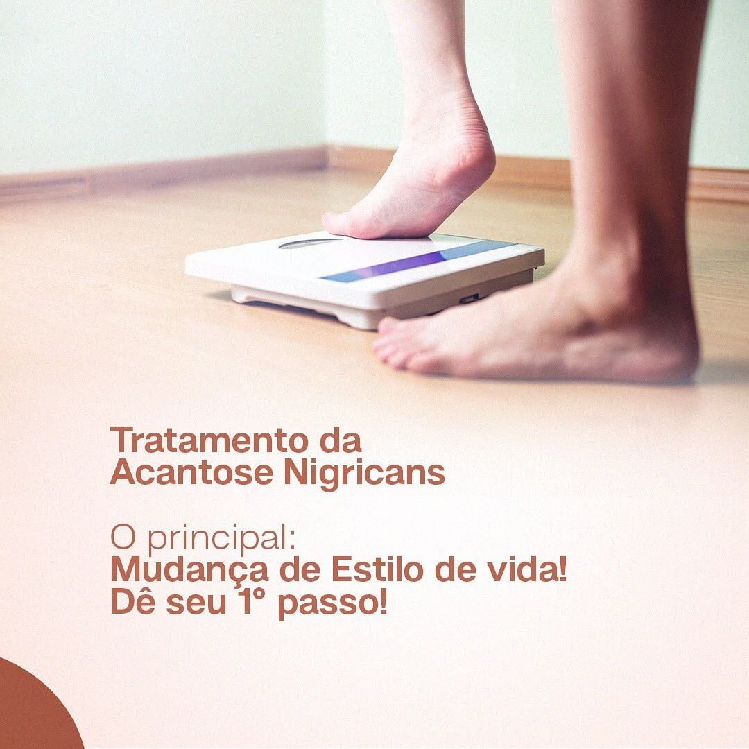Já ouviu falar de Acantose Nigricans ? Vamos entender melhor!