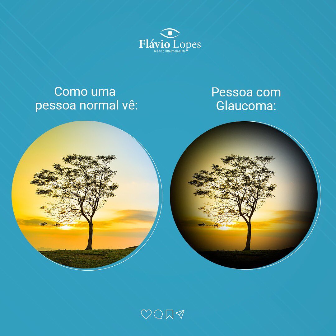 Já fez uma visita ao seu oftalmo esse ano?