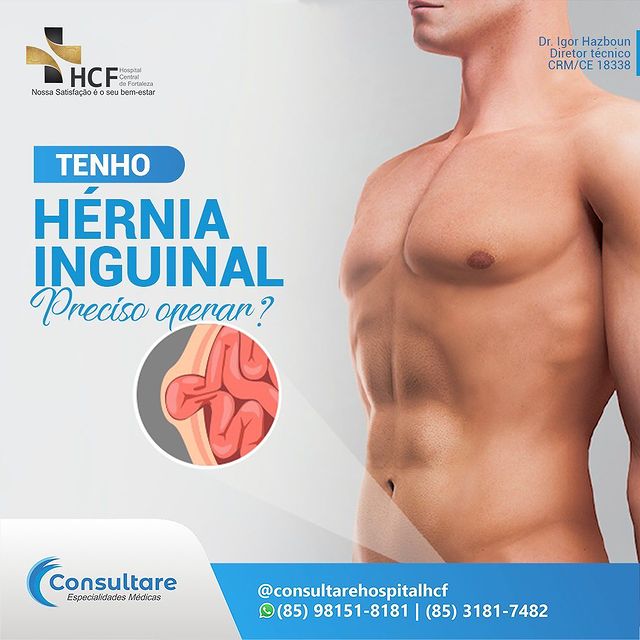 Dúvidas sobre a Hérnia Inguinal?