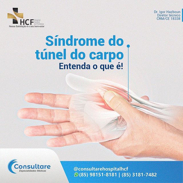 Nosso assunto de hoje é entender  o que é a síndrome  do túnel do carpo.