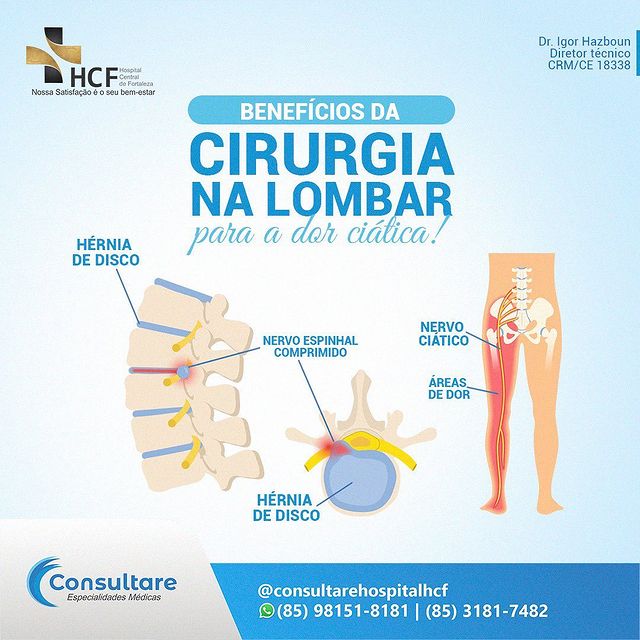 Benefícios da cirurgia  na  lombar  para a dor ciática.