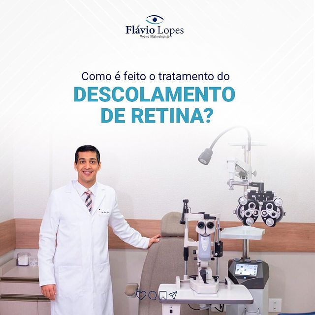 Como é feito o deslocamento de retina?