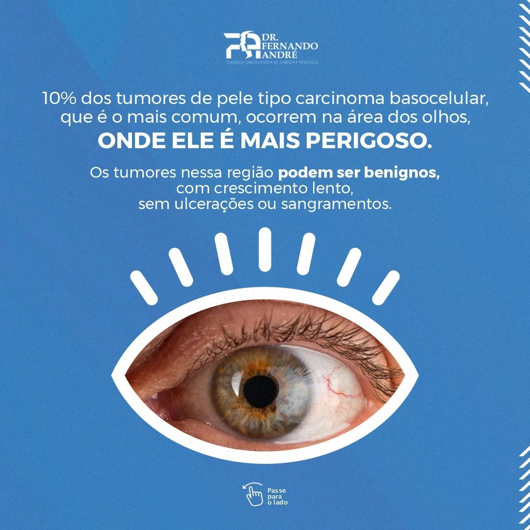 Você tem cuidado com os seus olhos?