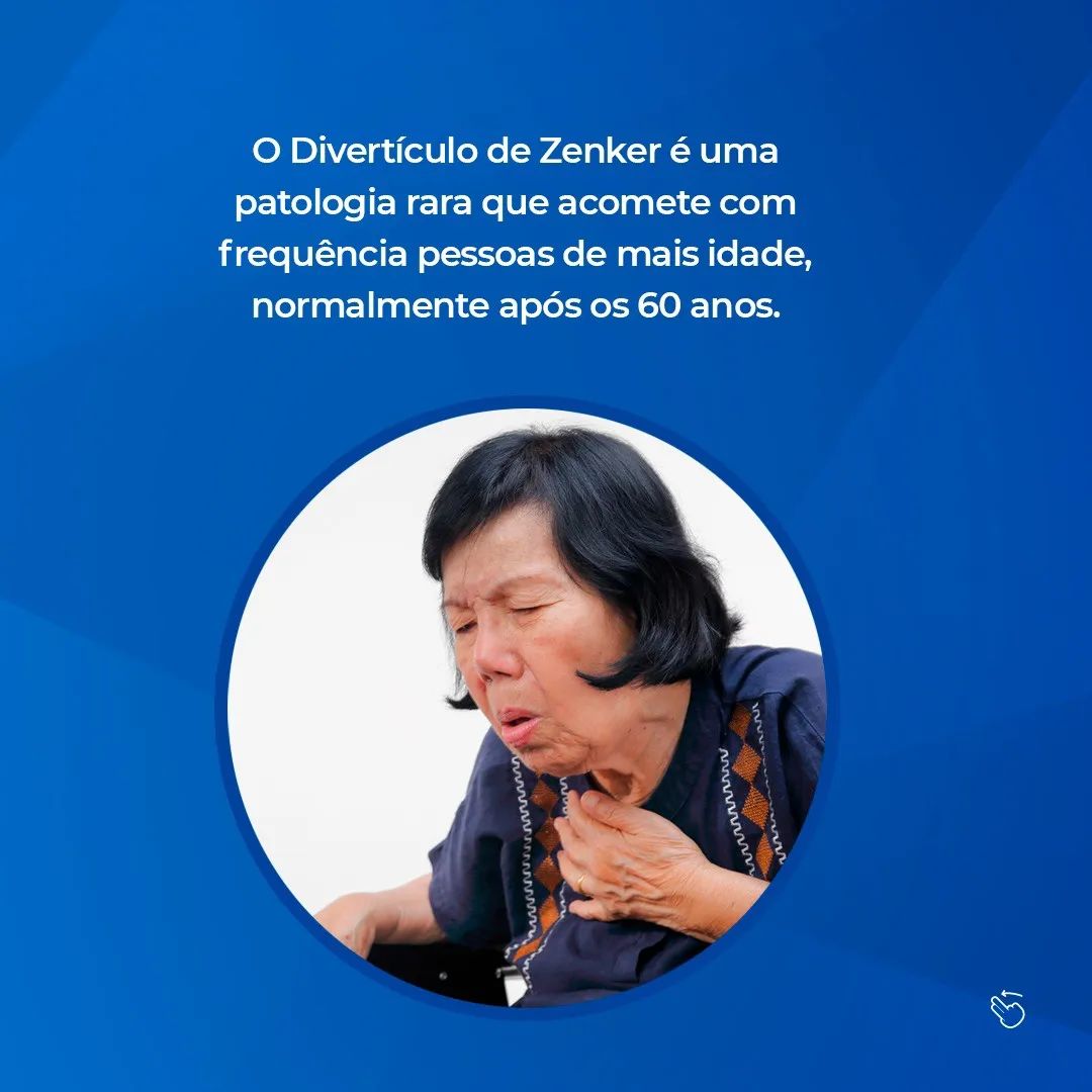 Fique  por dentro  sobre  o  tratamento do Divertículo de Zenke.