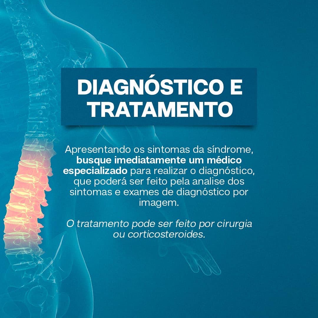 Síndrome da cauda equina!