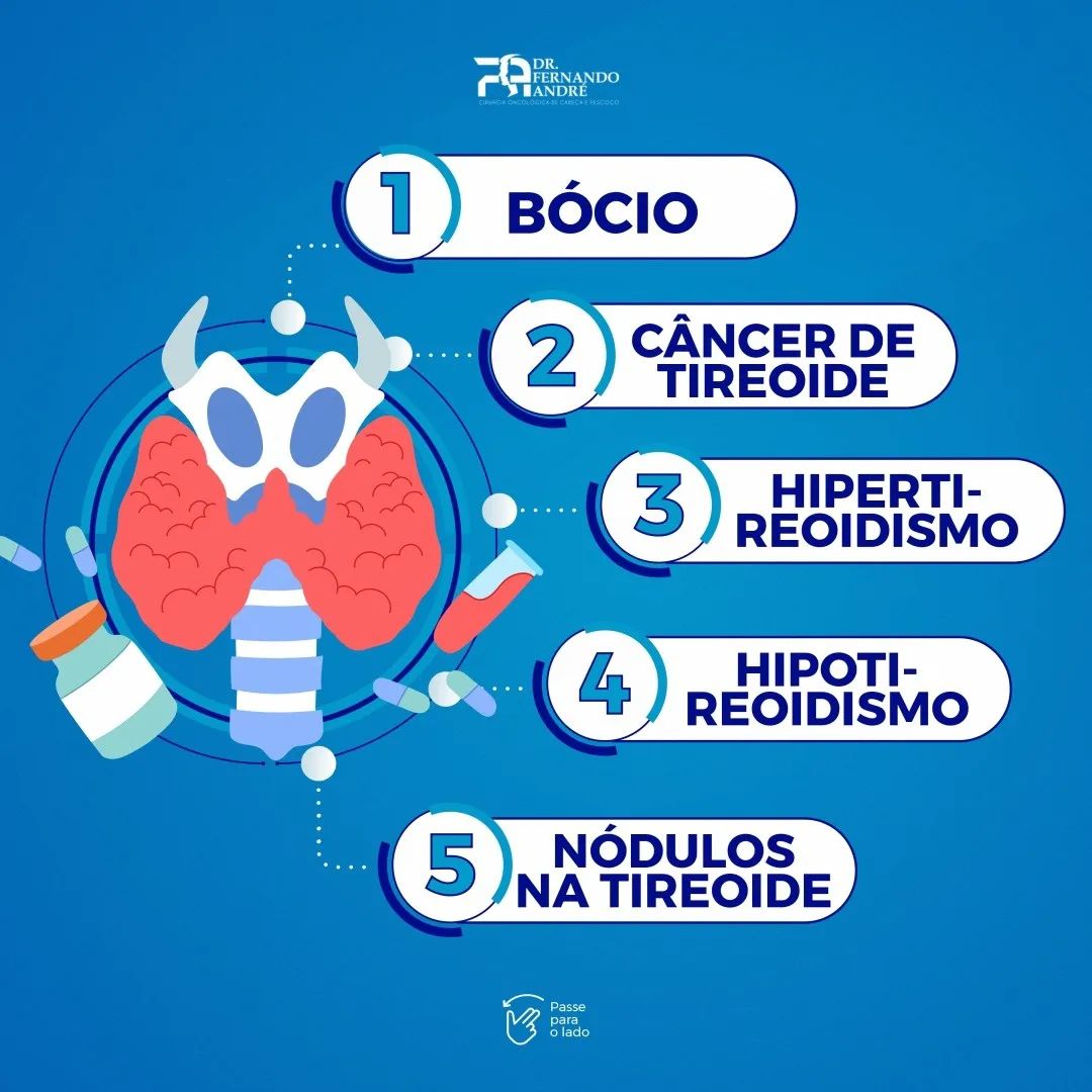 Já conheciam essas doenças da tireoide?