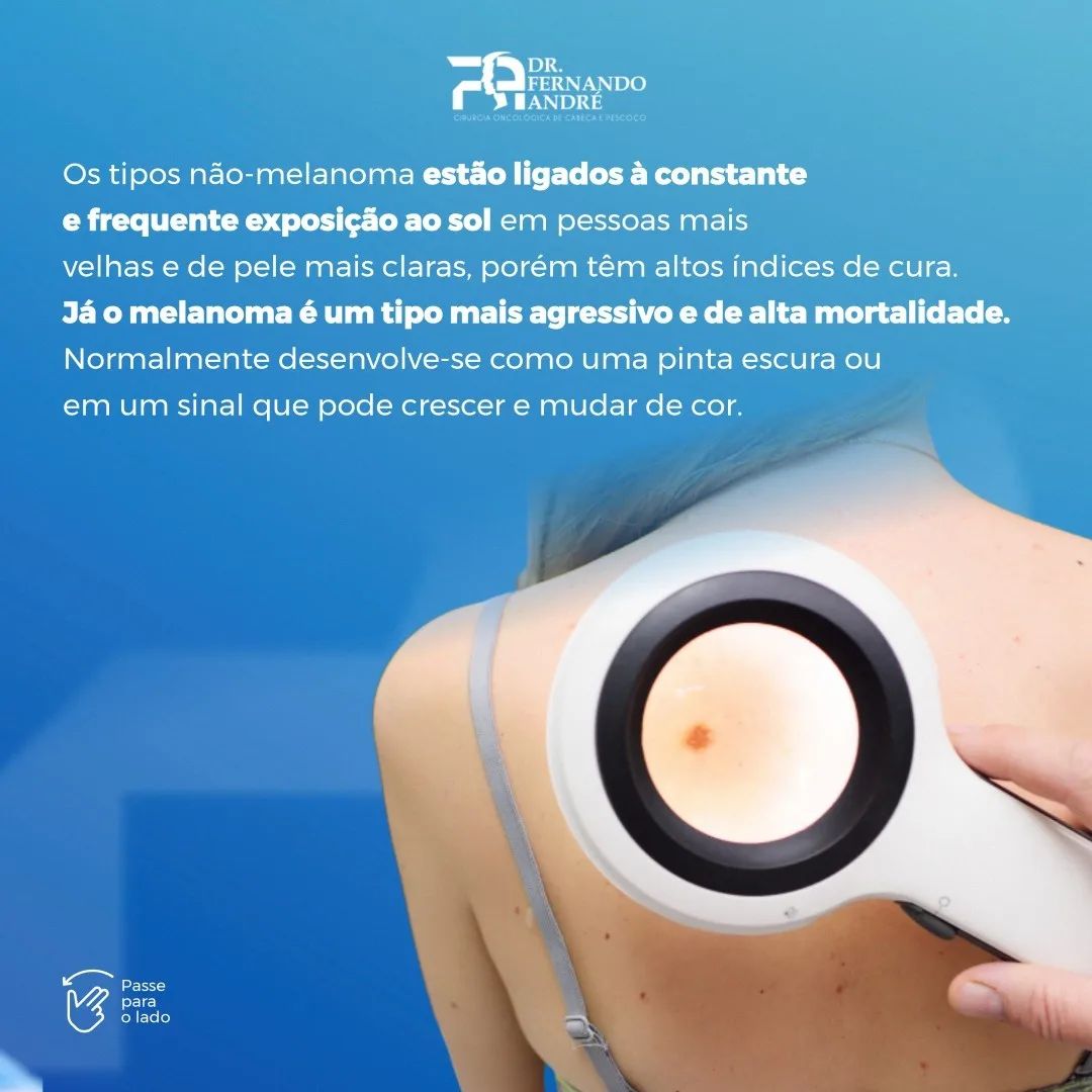 Conhece alguém que detesta utilizar proteção solar?
