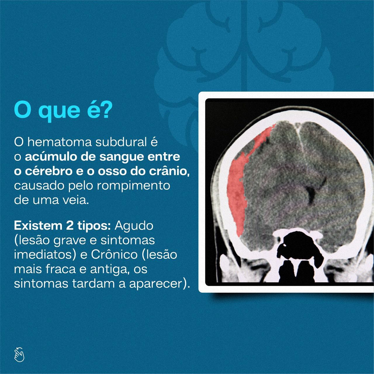Já tinha ouvido falar sobre essa condição?